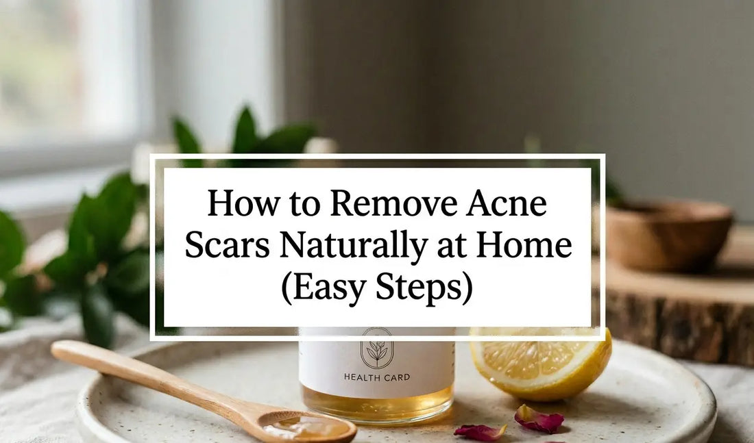 How to Remove Acne Scars Naturally at Home (Easy Steps)