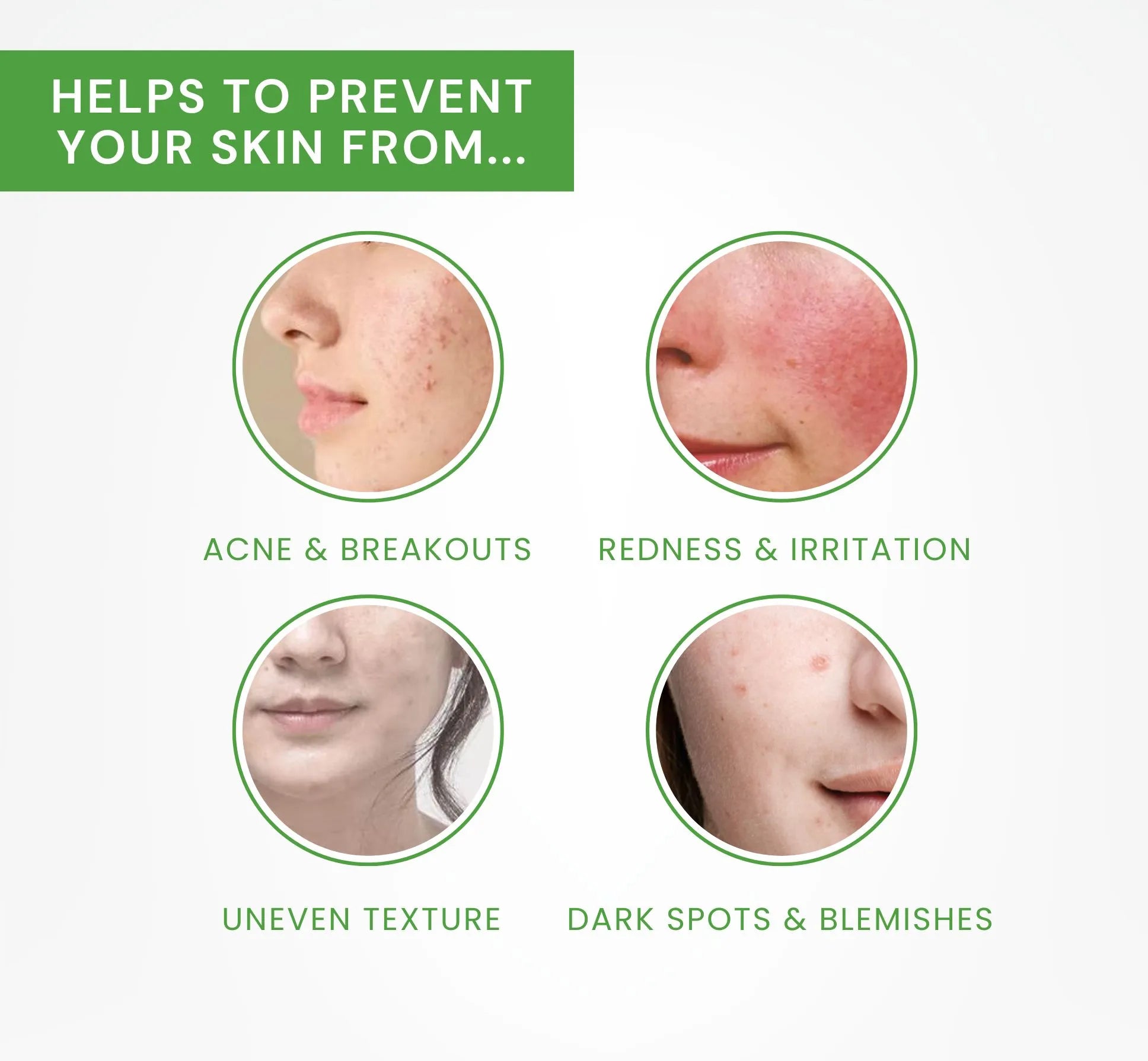 Skincare product advertisement showing effects on skin with text 'Helps to prevent your skin from acne, redness and irritation, dark spots' on a green background.